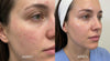 Gant exfoliant en soie pour visage